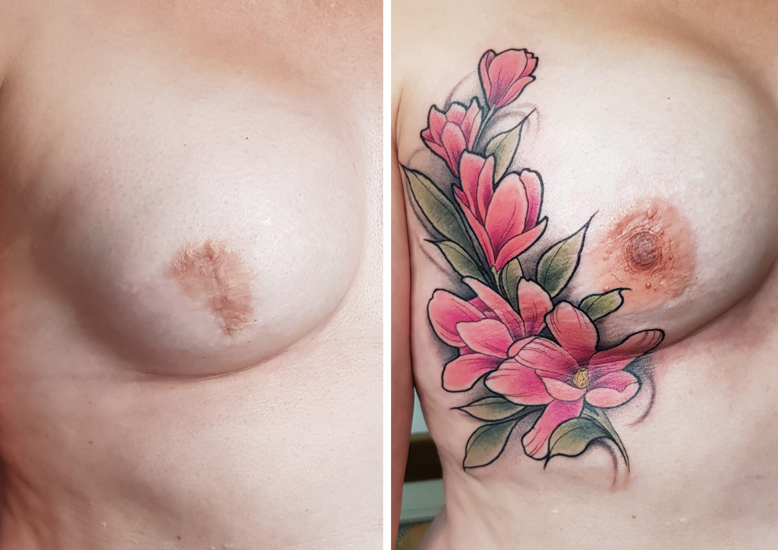 3D Realistic Nipple Tattoo and Tattoo design, post mastectomy, breast cancer survivor.