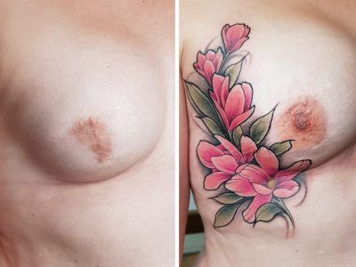 3D Realistic Nipple Tattoo and Tattoo design, post mastectomy, breast cancer survivor.